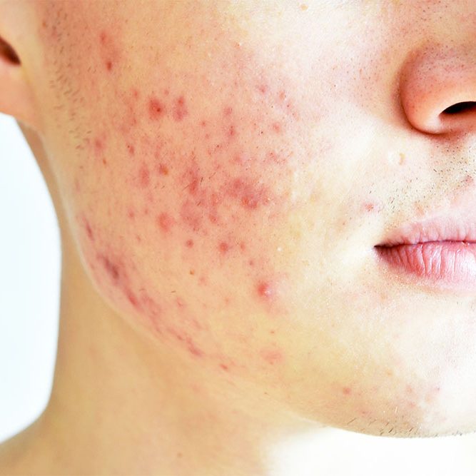 Side View Of A Young Businesswoman Suffering From Back Pain In O