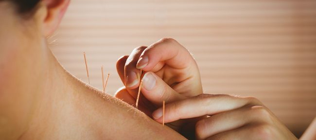 Sports acupuncture